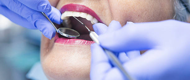 Best Emergency Dentist for Knocked-Out Tooth in Spencer, OK